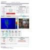 thermography infrared