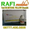 test kit metanil yellow
