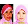 paket dermature bpom rp 115.000-1