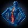 akupunktur untuk nyeri punggung bawah atau low back pain ( lbp)