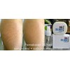 penghilang stretchmark dan selulit aman berbpom dan cepat-4