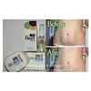 penghilang stretchmark dan selulit aman berbpom dan cepat-3