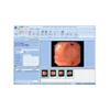endoscopy olympus 140 series complete system (alat kesehatan lainnya)-4