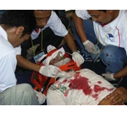 First Aid Training - Advance