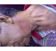 obat kulit paling ampuh