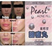 Pearl Acne Pill