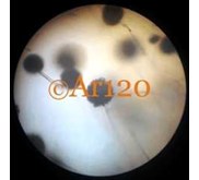Aspergillus Niger