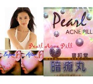 PIL JERAWAT ACNE PIL HARGA TERMURAH HUB: 081318873454