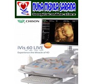 USG 4G Chison ivis 60 Live [ 4 Dimensi]