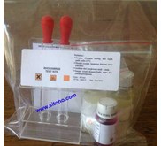 RHODAMIN B TEST KIT, JUAL TEST KIT RHODAMIN B, TEST KIT PEWARNA MAKANAN, REAGENT FOOD SECURITY KIT, JUAL ALAT UJI RODAMIN B PADA MAKANAN, TEST KIT RODAMIN B INDONESIA, TEST KIT RHODAMIN B, UJI RODAMIN B PADA MAKANAN, REAGENT RHODAMIN B TEST KIT