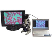 Mikroskop LBA ( LIVE BLOOD ANALYSIS)