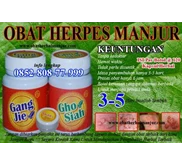 Obat Herpes Simplex Paling Manjur | 0852-808-77-999