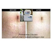 MSI Fruit Serum Stem Cell 