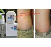 Penghilang Stretchmark dan Selulit Aman berBPOM Dan Cepat