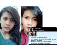 Swiss Paris Lotion Penghilang Kutil Dan Tahi Lalat