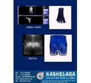 Phantom X-Ray Imaging Manus / Hand