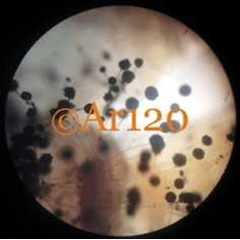 aspergillus niger