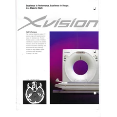 ct scan