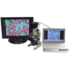 mikroskop lba ( live blood analysis)
