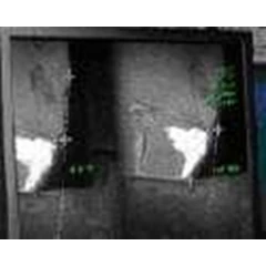 xlg3 videoprobe accessories - ndt - measurement options