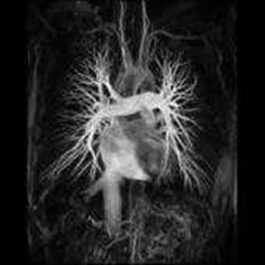 ct scan 16 slice hitachi