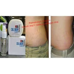 penghilang stretchmark dan selulit aman berbpom dan cepat
