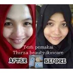 penghilang jerawat dan lubang bekas jerawat aman tanpa efek samping