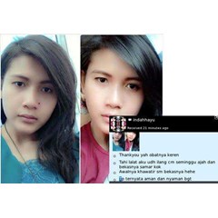 swiss paris lotion penghilang kutil dan tahi lalat