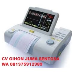 fetal monitor atau cardiotocography  (ctg)