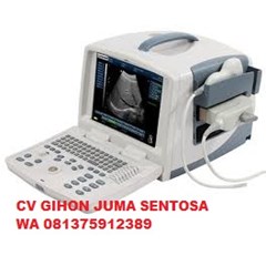 usg (ultrasonografi)