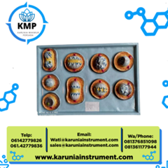 model mitosis - alat peraga pendidikan