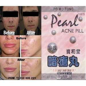 pearl acne pill