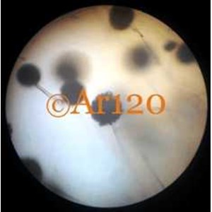 aspergillus niger
