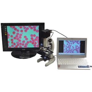 mikroskop lba ( live blood analysis)