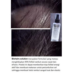 biohairs solution - serum penumbuh rambut rontok dan botak revolusioner-5