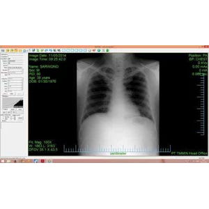 digital radiography system / dr-5