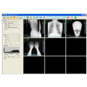 digital radiography system / dr