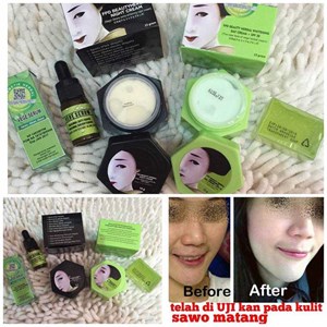 paket fpd beauty herbal -3