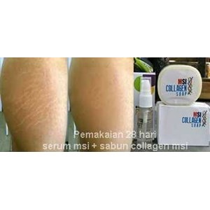 penghilang stretchmark dan selulit aman berbpom dan cepat-4
