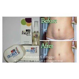 penghilang stretchmark dan selulit aman berbpom dan cepat-3