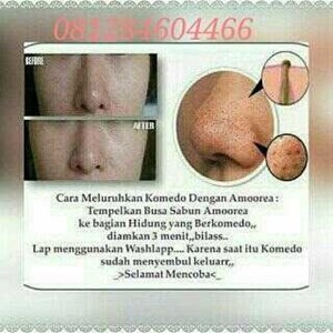 nu amoorea/sabun amoorea beauty bar new plus apple stemcell stem cell-1