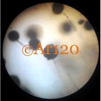 Aspergillus Niger
