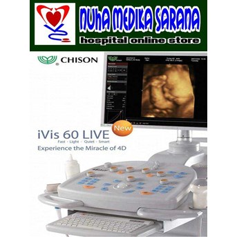 USG 4G Chison ivis 60 Live [ 4 Dimensi]