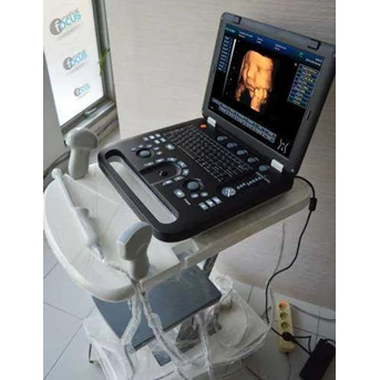 USG 4D ECARE Type EC50B, 4D Laptop Ultrasound, layar 15 inch, Dengan Battery bisa digunakan 2 jam