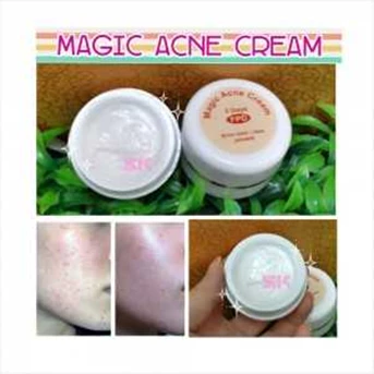 Magic acne cream