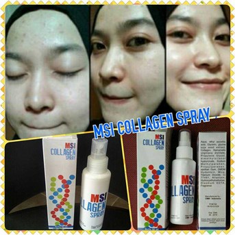 MSI Collagen Spray. Dijamin Asli 100% dan Termurah