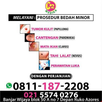 Praktek Dokter Umum Melayani Prosedur Bedah Minor